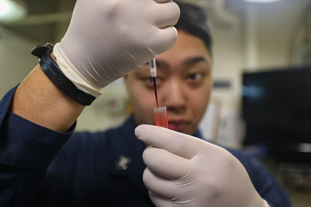 Technician examining a blood sample vial